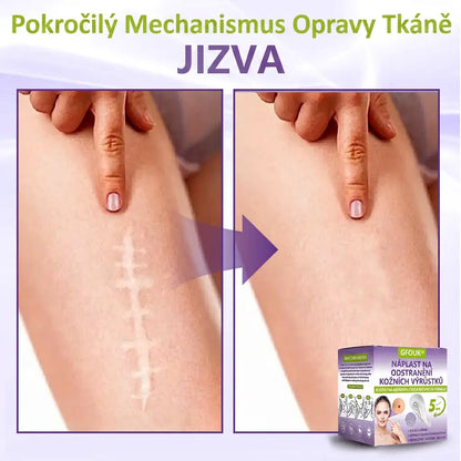 Vyrobeno a odesíláno z České republiky ✨ GFOUK® Rozpustné mikronáplasťové botanické náplasti na kožní výrůstky 🌴🌴
