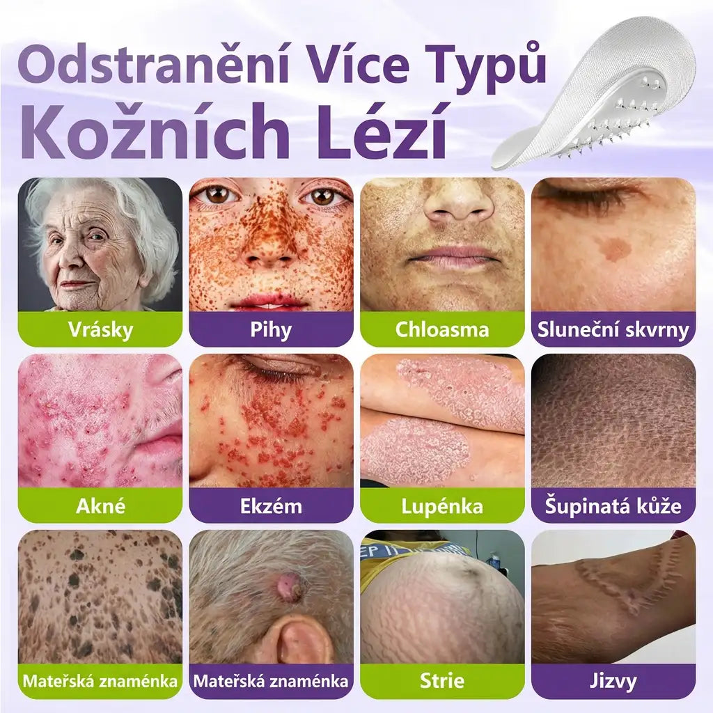 Vyrobeno a odesíláno z České republiky ✨ GFOUK® Rozpustné mikronáplasťové botanické náplasti na kožní výrůstky 🌴🌴